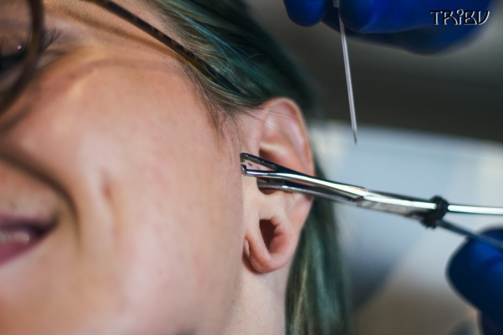 Close-Up of Ear Piercing Needle and Clamp Process